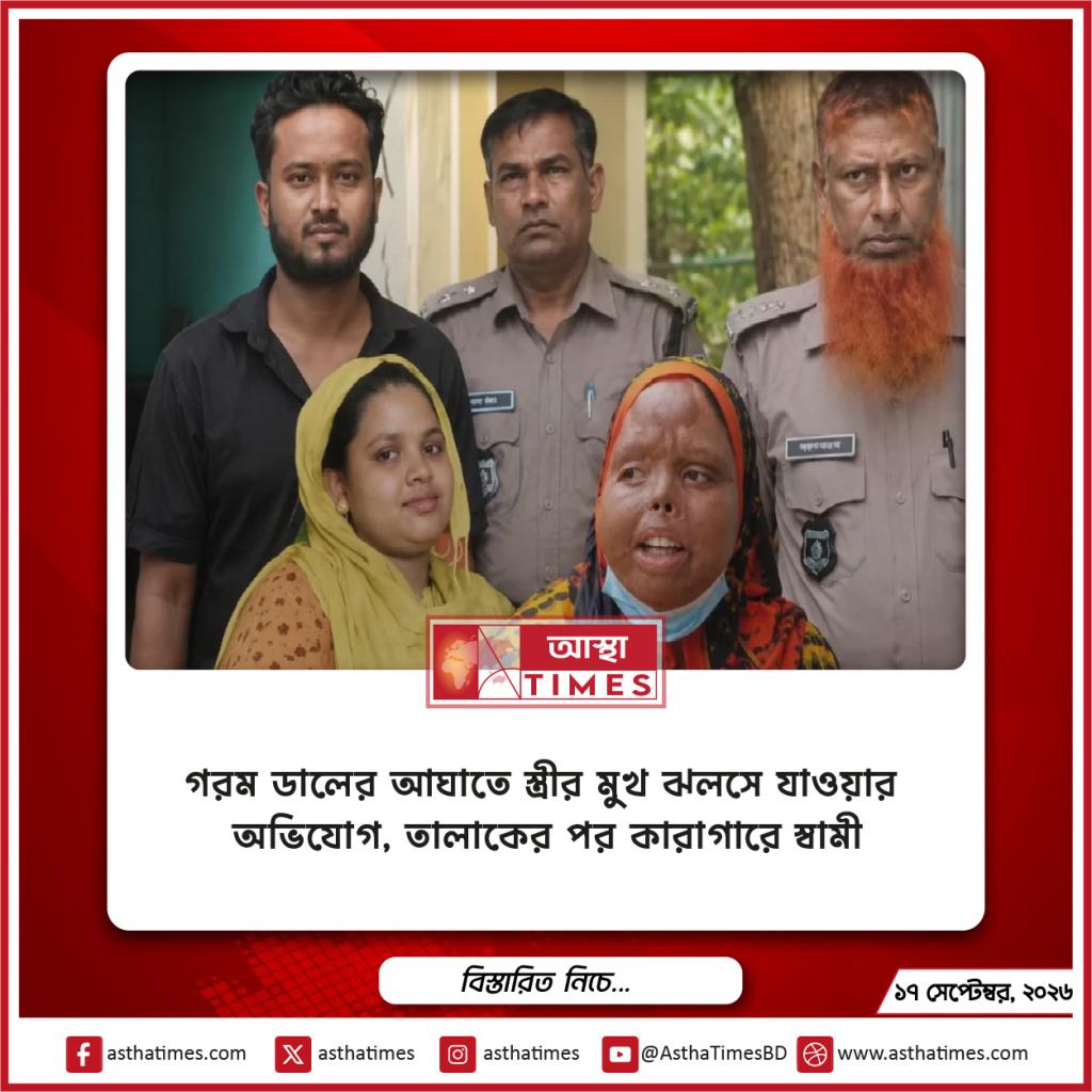 গরম ডালের আঘাতে স্ত্রীর মুখ ঝলসে যাওয়ার অভিযোগ, তালাকের পর কারাগারে স্বামী
