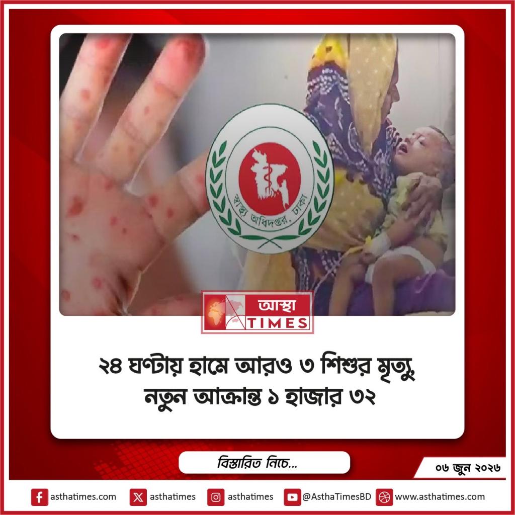২৪ ঘণ্টায় হামে আরও ৩ শিশুর মৃত্যু, নতুন আক্রান্ত ১ হাজার ৩২